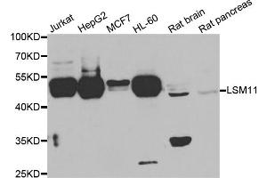Western blot analysis of extracts of various cell lines, using LSM11 antibody. (LSM11 antibody)