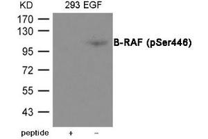 Western blot analysis of extracts from 293 cells treated with EGF using B-RAF (Phospho-Ser446) Antibody. (BRAF antibody  (pSer446))