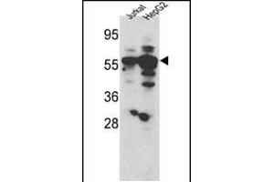 Western blot analysis of hSGKL- (SGK3) (ABIN1882132 and ABIN2842051) in Jurkat and HepG2 cell line lysates (35 μg/lane). (SGK3 antibody  (AA 108-139))