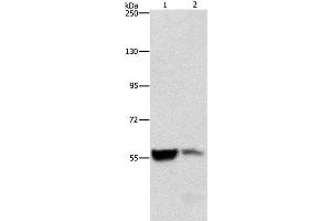 Western Blot analysis of Mouse liver and kidney tissue using ALDH8A1 Polyclonal Antibody at dilution of 1:550 (ALDH8A1 antibody)