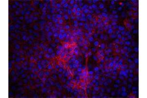 Immunofluorescence (IF) image for anti-CD47 (CD47) antibody (ABIN2664729) (CD47 antibody)