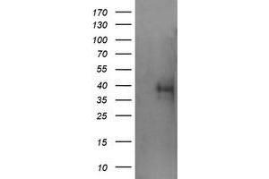 Image no. 2 for anti-Tripartite Motif Containing 44 (TRIM44) antibody (ABIN1501507) (TRIM44 antibody)
