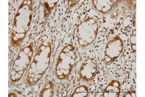 Image no. 1 for anti-Elongator Complex Protein 1 (ELP1) (AA 1242-1332) antibody (ABIN599043) (IKAP/p150 antibody  (AA 1242-1332))