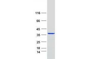 Validation with Western Blot