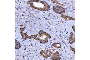 IHC analysis of SARS2 using anti-SARS2 antibody (ABIN7601804). (SARS2 antibody  (AA 46-518))
