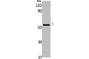 Western Blot analysis of K562 cells using GDI-1 Polyclonal Antibody (GDI1 antibody  (C-Term))