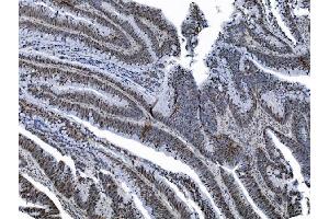 IHC analysis of MCM6 using anti-MCM6 antibody (ABIN7600036).