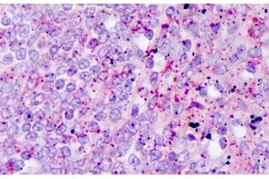 Anti-IL-17 antibody IHC staining of human t lymphocytes. (Interleukin 17a antibody)
