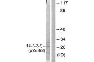 Western blot analysis of extracts from NIH-3T3 cells treated with UV 30', using 14-3-3 zeta (Phospho-Ser58) Antibody. (14-3-3 zeta antibody  (pSer58))