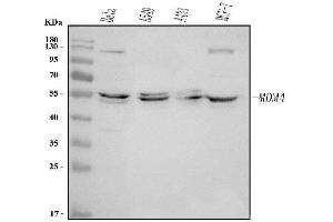 Western blot analysis of MDMX/MDM4 using anti-MDMX/MDM4 antibody (ABIN7602490).