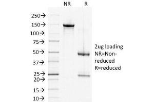 SDS-PAGE Analysis of Purified, BSA-Free DSG2 Antibody (clone 6D8). (Desmoglein 2 antibody)