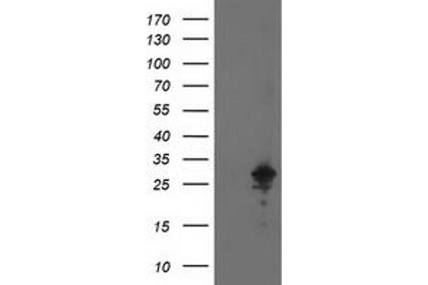 AK4 antibody