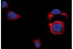 Immunofluorescent analysis of CD226 staining in HeLa cells. (CD226 antibody  (C-Term))