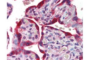 Anti-ABCB4 antibody IHC of human placenta. (ABCB4 antibody  (AA 252-301))
