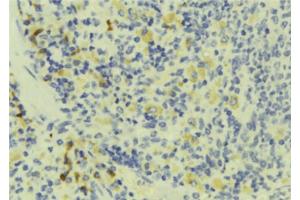 ABIN6273178 at 1/100 staining Human lymph tissue by IHC-P. (TMSB4X antibody  (N-Term))