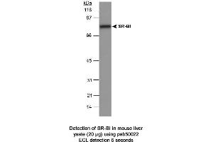 Image no. 1 for anti-Scavenger Receptor Class B, Member 1 (SCARB1) (C-Term) antibody (ABIN363331)