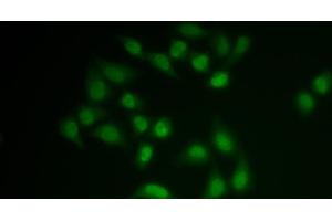 Immunofluorescence analysis of MCF-7 cells using CHAT Polyclonal Antibody (Choline Acetyltransferase antibody)