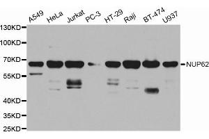 Western blot analysis of extracts of various cell lines, using NUP62 antibody. (NUP62 antibody  (AA 403-522))