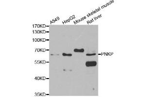 Western blot analysis of extracts of various cell lines, using PNKP antibody. (PNKP antibody)