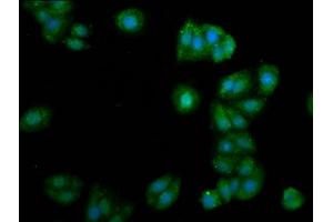 Immunofluorescence staining of HepG2 cells with ABIN7153741 at 1:105, counter-stained with DAPI. (ALG11 antibody  (AA 416-480))