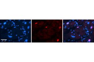 Rabbit Anti-Pou3f3 Antibody  Catalog Number: ARP57888_P050 Formalin Fixed Paraffin Embedded Tissue: Human Adult heart  Observed Staining: Nuclear Primary Antibody Concentration: 1:600 Secondary Antibody: Donkey anti-Rabbit-Cy2/3 Secondary Antibody Concentration: 1:200 Magnification: 20X Exposure Time: 0. (POU3F3 antibody  (C-Term))