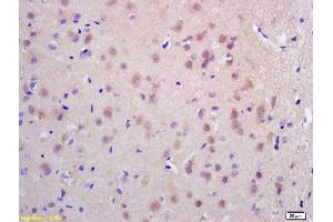 Formalin-fixed and paraffin embedded rat brain labeled with Rabbit Anti CDC45L Polyclonal Antibody, Unconjugated (ABIN873072) at 1:200 followed by conjugation to the secondary antibody and DAB staining (CDC45 antibody  (AA 485-566))