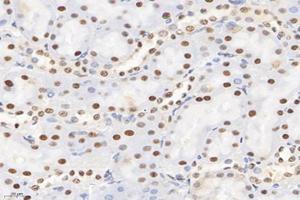 Immunohistochemistry analysis of paraffin-embedded rat kidney using,SET (ABIN7075583) at dilution of 1: 10000 (SET/TAF-I antibody)