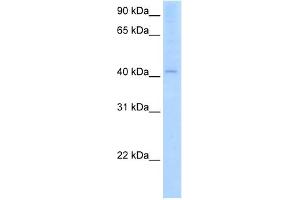 WB Suggested Anti-AADAC Antibody Titration:  2.