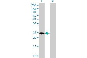 Western Blot analysis of GSTA4 expression in transfected 293T cell line by GSTA4 MaxPab polyclonal antibody. (GSTA4 antibody  (AA 1-222))