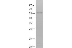 Western Blotting (WB) image for CUB Domain Containing Protein 1 (CDCP1) (AA 24-343) protein (His-IF2DI Tag) (ABIN7122512) (CDCP1 Protein (AA 24-343) (His-IF2DI Tag))