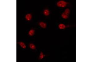 ABIN6266723 staining HT29 by IF/ICC. (T-Box 10 antibody  (Internal Region))