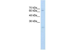 Carboxylesterase 2 antibody used at 0. (CES2 antibody)