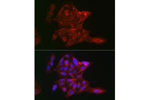 Immunofluorescence analysis of U-2 OS cells using LOX Rabbit pAb (ABIN6133805, ABIN6143288, ABIN6143289 and ABIN6223629) at dilution of 1:100 (40x lens). (LOX antibody)