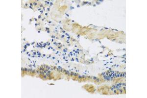 Immunohistochemistry of paraffin-embedded mouse lung using CLIP1 antibody (ABIN5975170) at dilution of 1/100 (40x lens). (CLIP1 antibody)