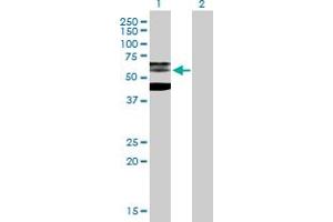Western Blot analysis of PHF21B expression in transfected 293T cell line by PHF21B MaxPab polyclonal antibody. (PHF21B antibody  (AA 1-531))