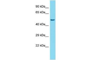 Western Blotting (WB) image for anti-Sorting Nexin Family Member 30 (SNX30) (Middle Region) antibody (ABIN2505774) (SNX30 antibody  (Middle Region))