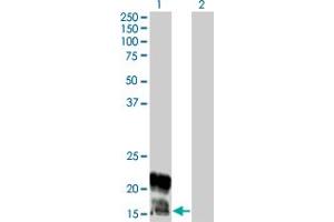 KCNE1 antibody  (AA 67-129)