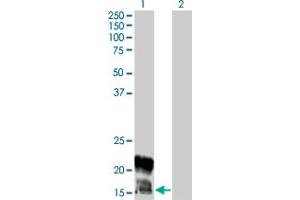Western Blot analysis of KCNE1 expression in transfected 293T cell line by KCNE1 monoclonal antibody (M01), clone 5B12. (KCNE1 antibody  (AA 67-129))