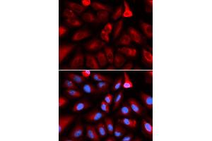 Immunofluorescence (IF) image for anti-FK506 Binding Protein 4, 59kDa (FKBP4) antibody (ABIN1876844) (FKBP4 antibody)