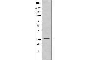 Western blot analysis of extracts from HepG2 cells using ATP5H antibody. (ATP5H antibody  (C-Term))