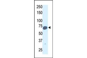 Image no. 1 for anti-Synovial Apoptosis Inhibitor 1, Synoviolin (SYVN1) (C-Term) antibody (ABIN357625)