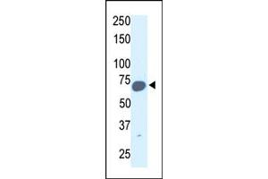 Image no. 1 for anti-Synovial Apoptosis Inhibitor 1, Synoviolin (SYVN1) (C-Term) antibody (ABIN357625) (SYVN1 antibody  (C-Term))