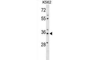 Western Blotting (WB) image for anti-PDZ and LIM Domain 4 (PDLIM4) antibody (ABIN2999859)