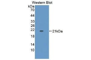 Detection of Recombinant ZG16B, Human using Polyclonal Antibody to Zymogen Granule Protein 16 Homolog B (ZG16B) (ZG16B antibody  (AA 53-208))