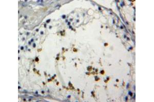 Used in DAB staining on fromalin fixed paraffin-embedded Testis tissue (FOXP1 antibody  (AA 461-671))