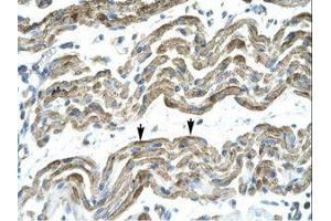 Image no. 1 for anti-Zinc Finger Protein 828 (ZNF828) (AA 261-310) antibody (ABIN202924) (ZNF828 antibody  (AA 261-310))