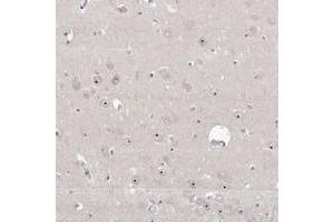 Immunohistochemical staining of human hippocampus with RBM28 polyclonal antibody  shows distinct nucleolar positivity in neuronal cells at 1:50-1:200 dilution.