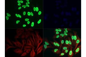 Immunofluorescence of Anti-Histone H3 K36ac: Histone H3 Ac Lys36 antibody was tested at 1:200,000 in HeLa cells with FITC (green).