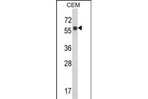 Western blot analysis of WDR1 Antibody (C-term) (ABIN389460 and ABIN2839527) in CEM cell line lysates (35 μg/lane).