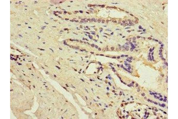 ACSF3 antibody  (AA 365-484)